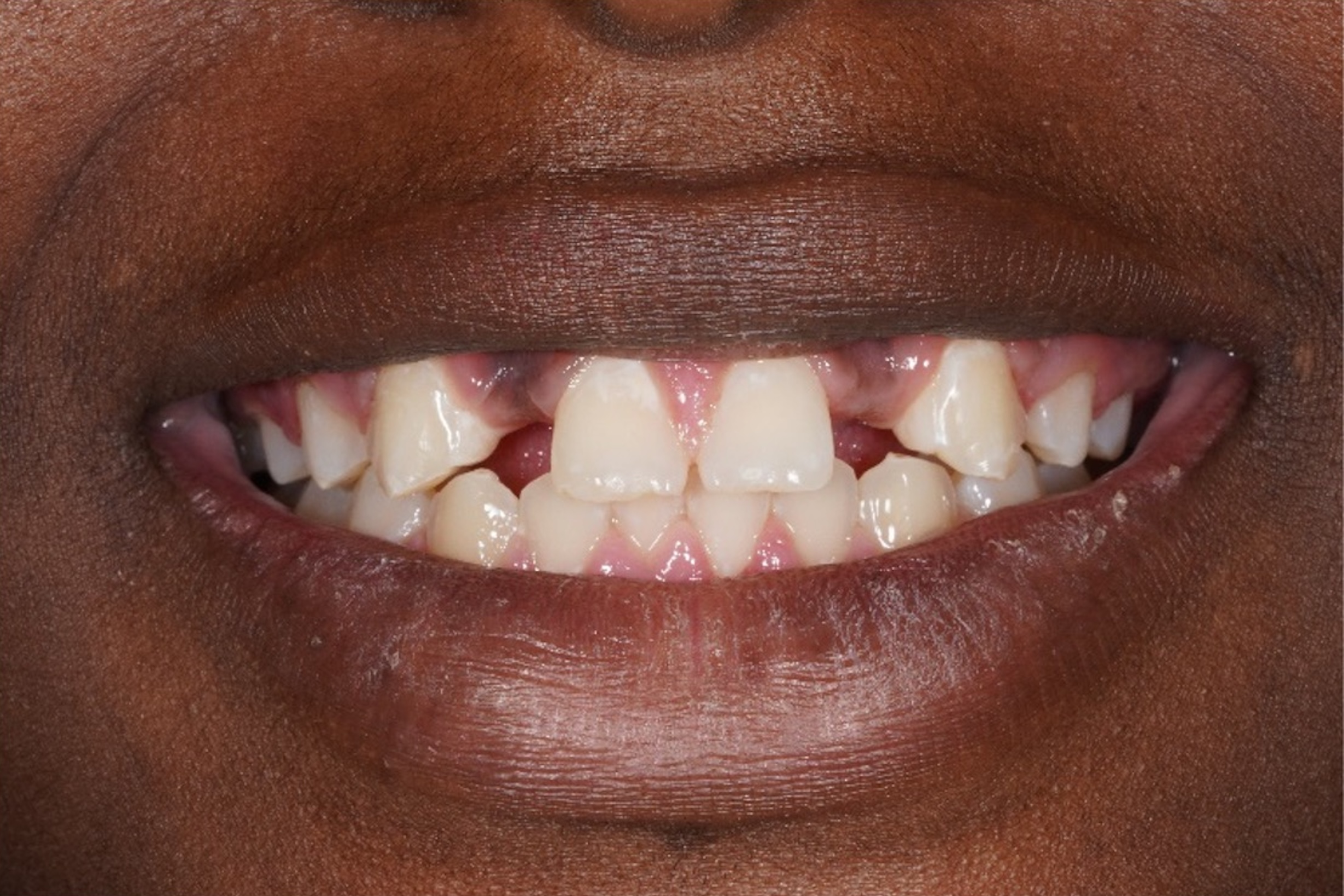 Before treatment